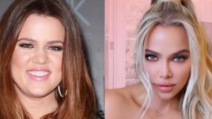 Read more about the article Khloe Kardashian Before and After