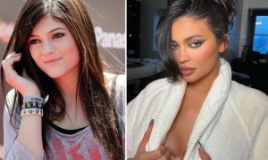 Read more about the article Kylie Jenner Before and After