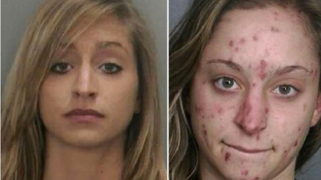 Read more about the article Meth Before and After