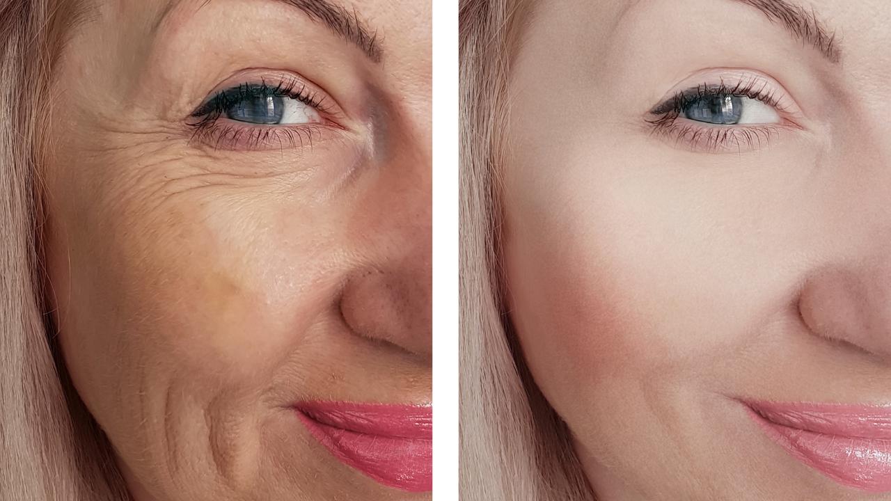 You are currently viewing Retinol Before and After